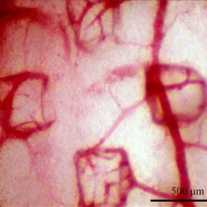帮助血管修复的智能绷带