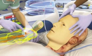 医治烧伤的生物面具