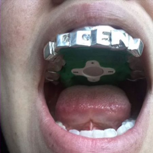 从嘴里听音乐——另类MP3