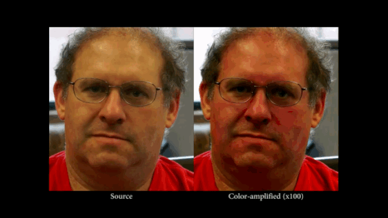 欧拉视频放大技术