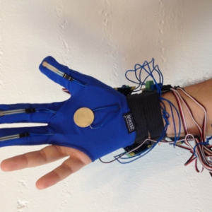 辅助医生治疗的智能手套