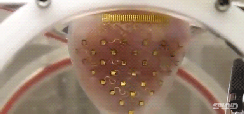 让心脏持续跳动的电子心包膜