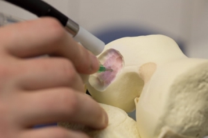 “写骨“手术笔