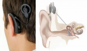 梅尼埃尔氏综合症病友的新辅助设备